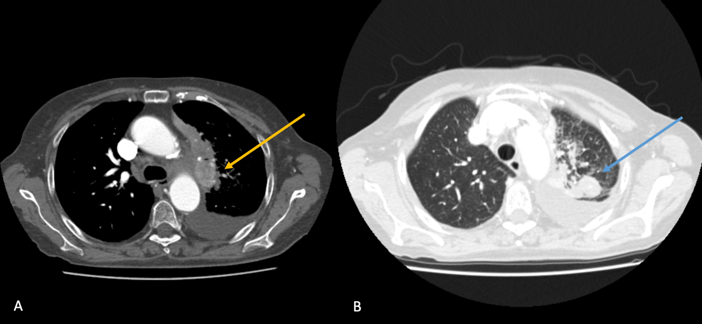 Radiologische Befunde AB.png